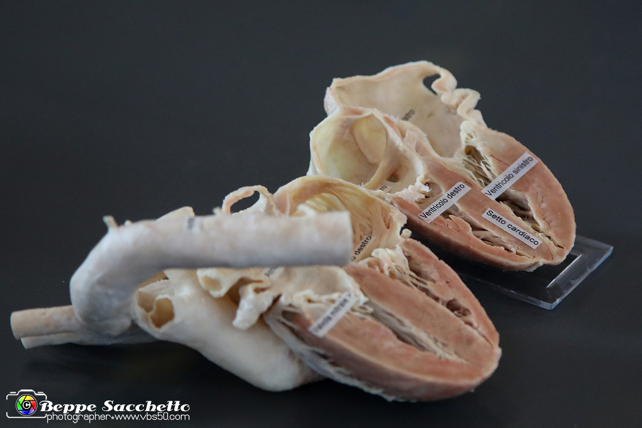 VBS_2842 - Cuore - Mostra Body Worlds.jpg